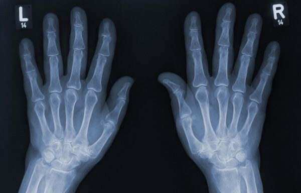 X-Ray Scan Services